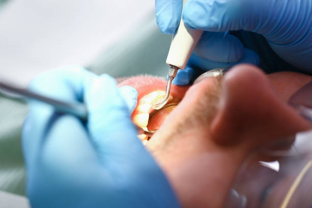 Best Emergency Treatment for Oral Infections in Redlands, CA