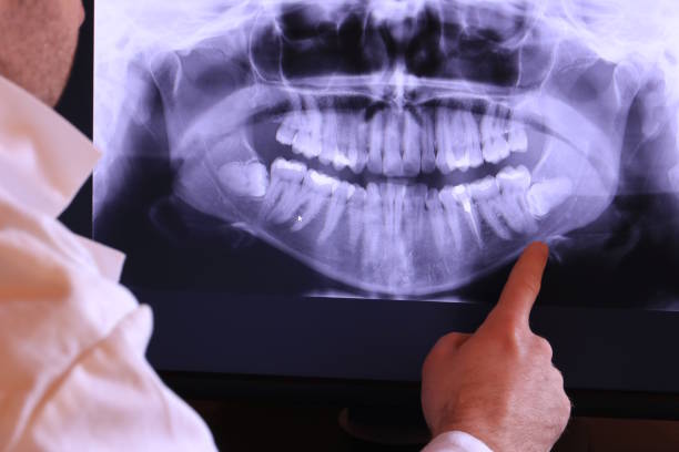 Best Emergency Denture Repair in Redlands, CA
